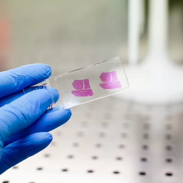 Histopathological examination