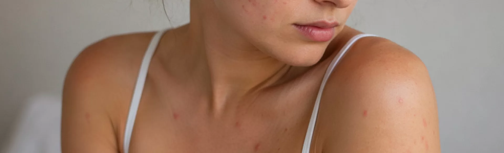 Red bumps on the body