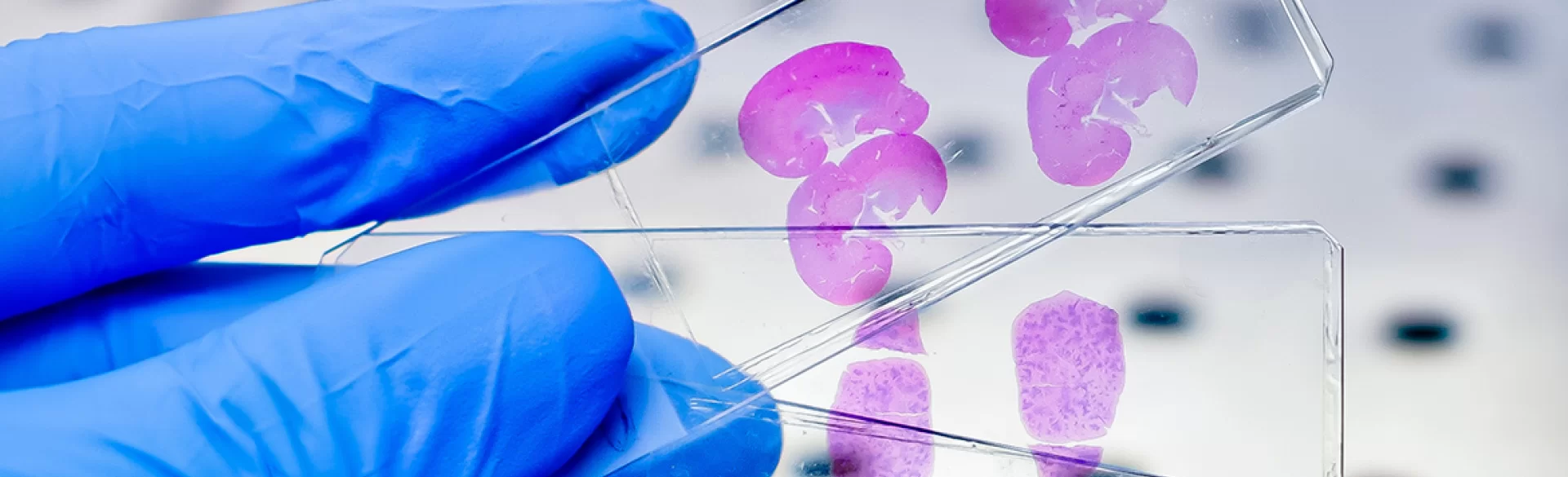 Long wait for histopathological result