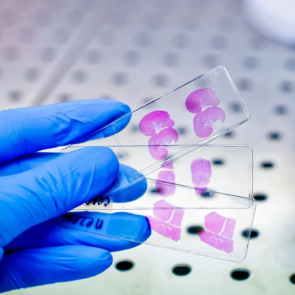 Long wait for histopathological result