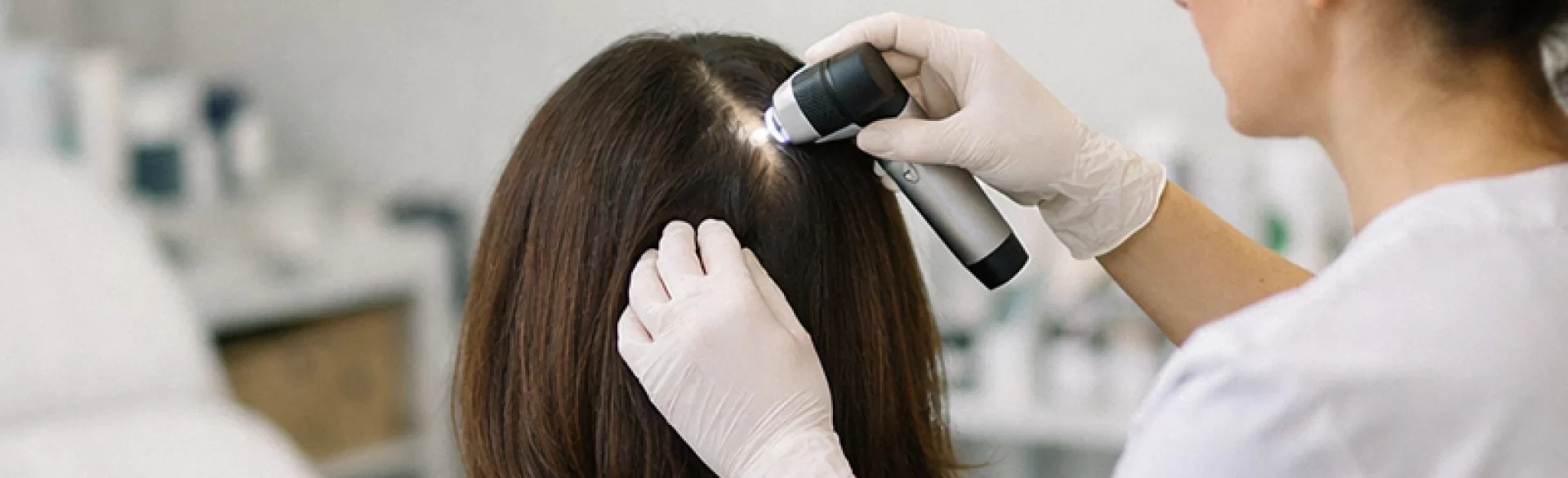 Fungal infection of the scalp