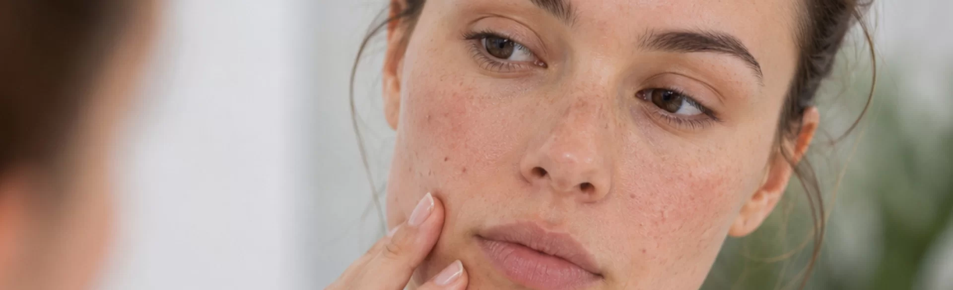 Insulin resistance and skin