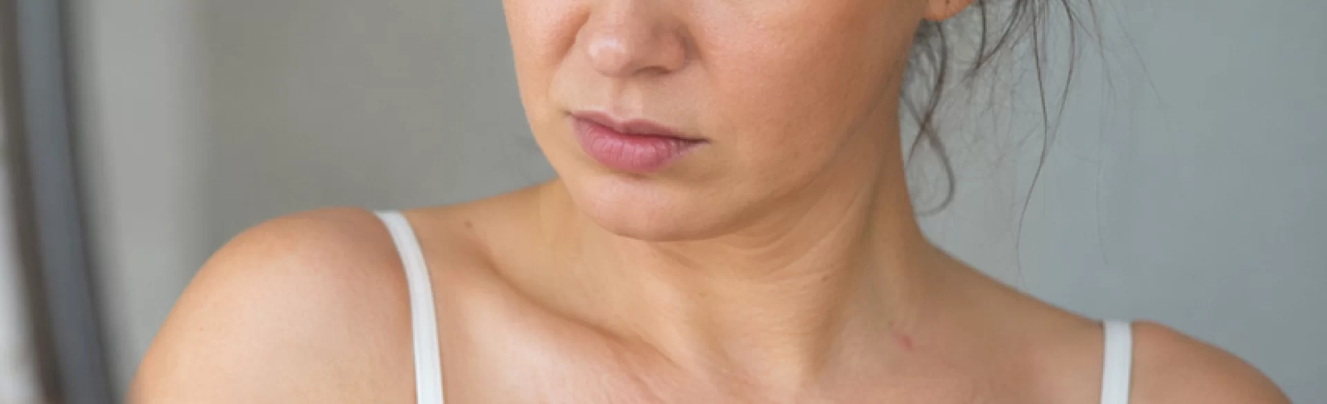 Pimples on the décolletage