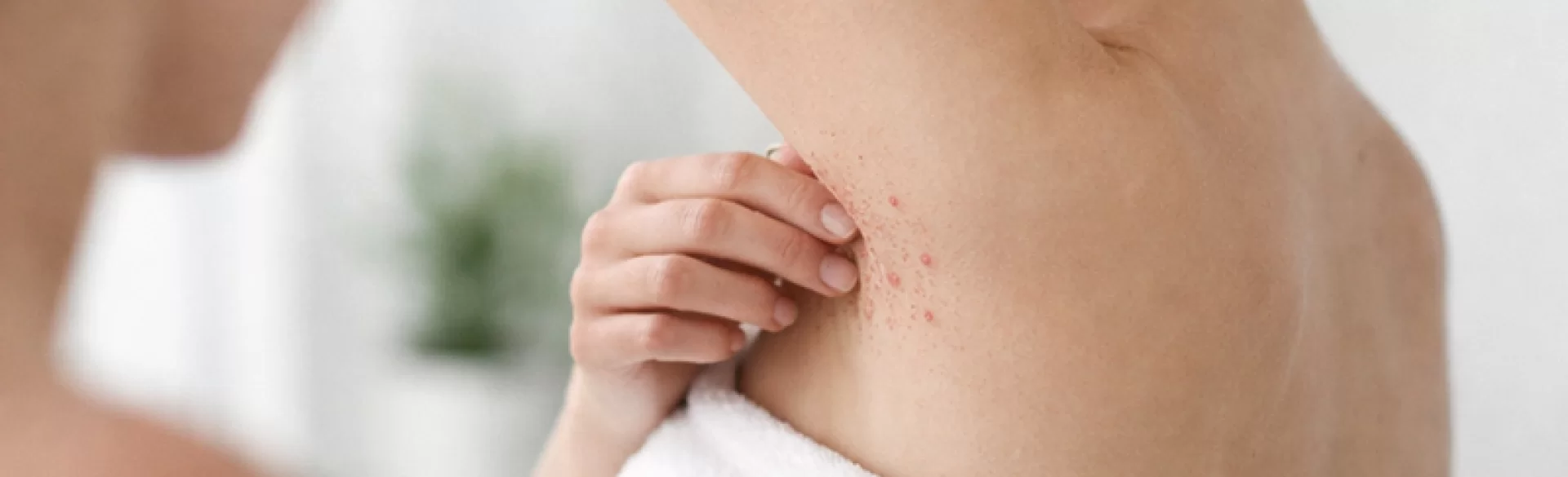 Boils under the armpits