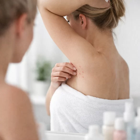 Boils under the armpits