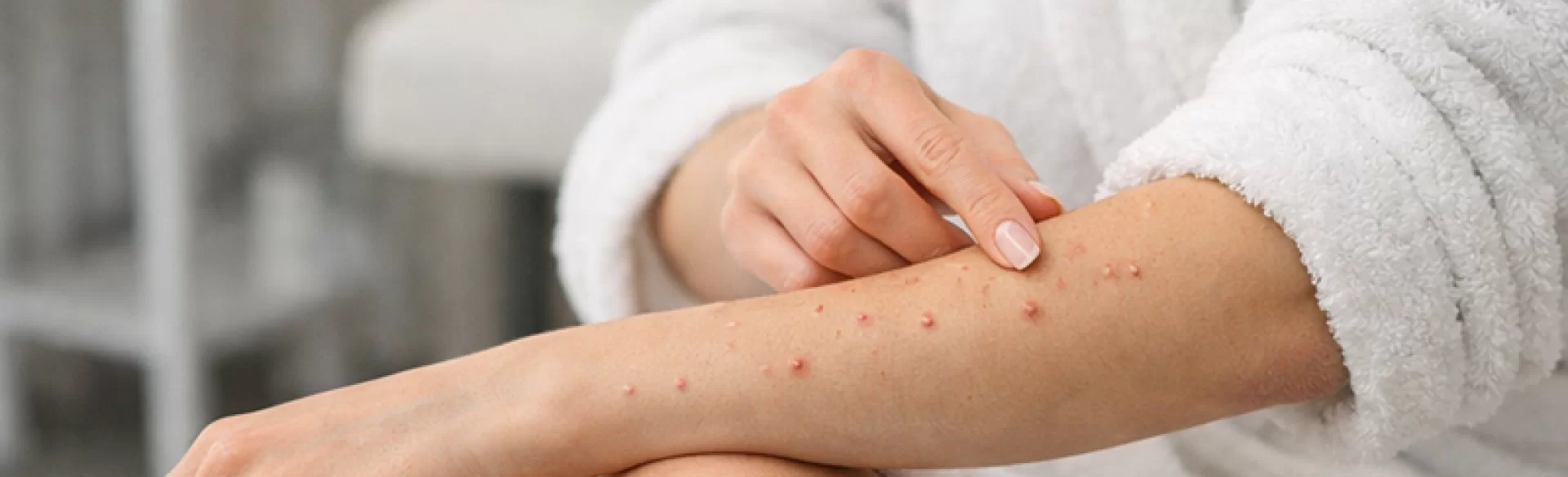 Pustular pimples on the hands