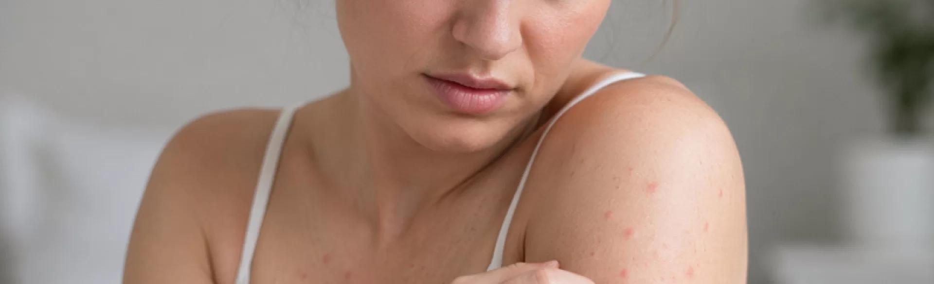 Itchy bumps on the body