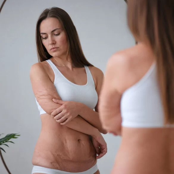 Lipodystrophy