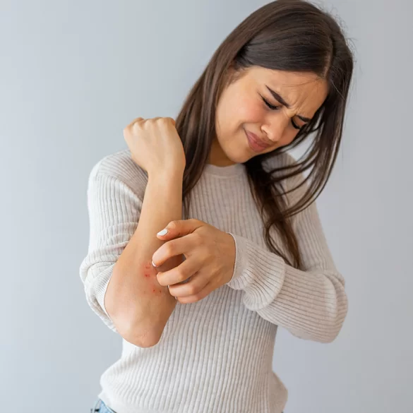 Pustular psoriasis