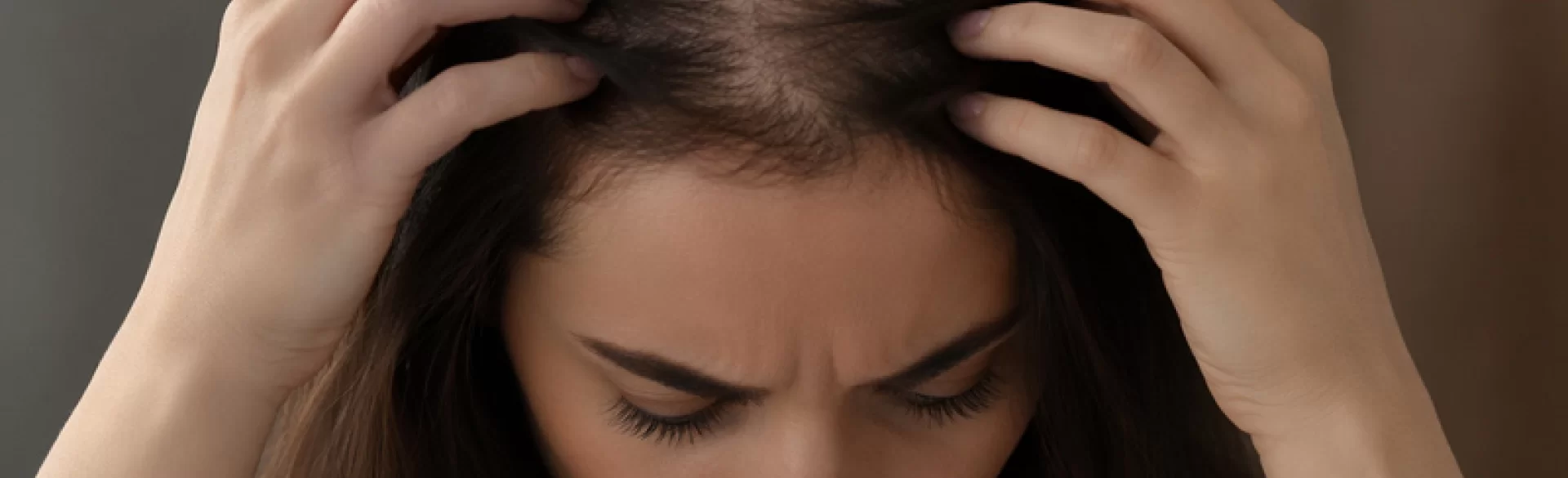 Diffuse alopecia