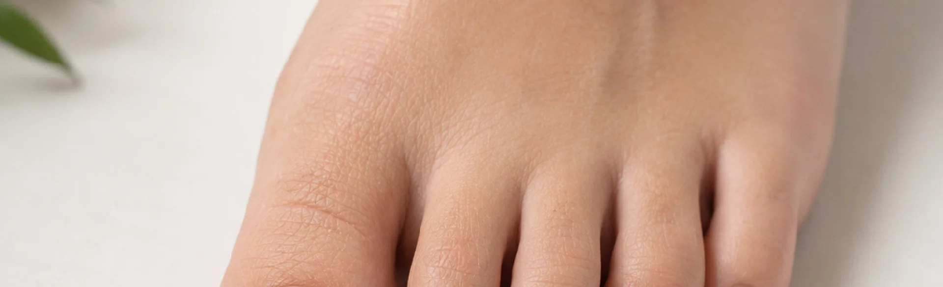 Onycholysis