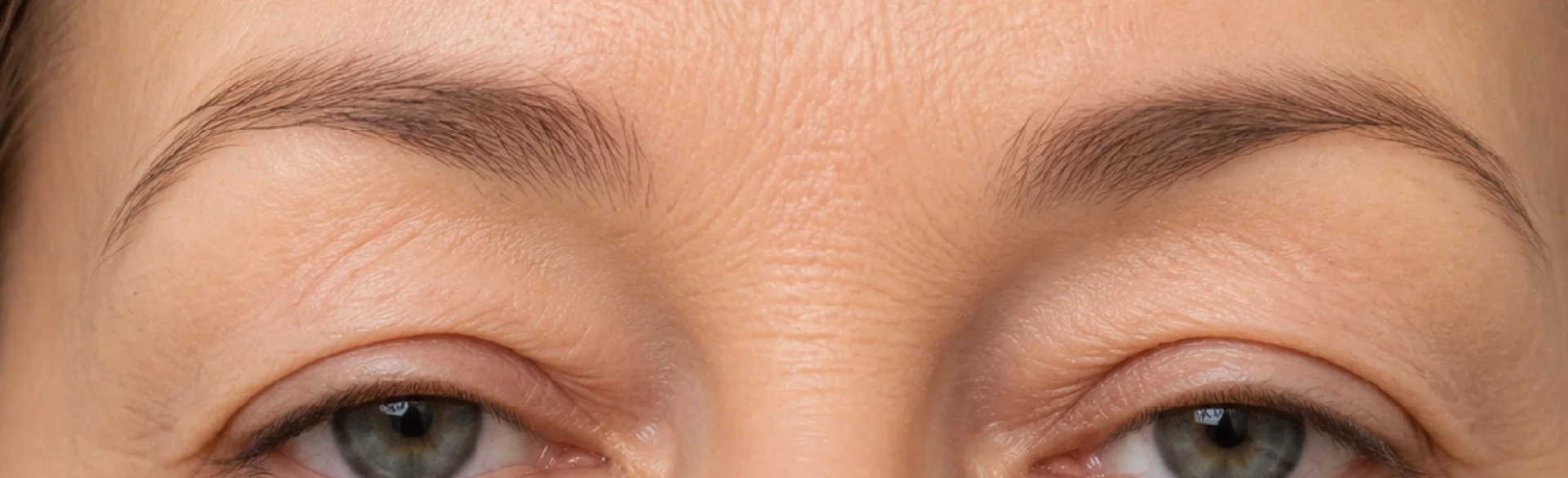 Drooping eyelids