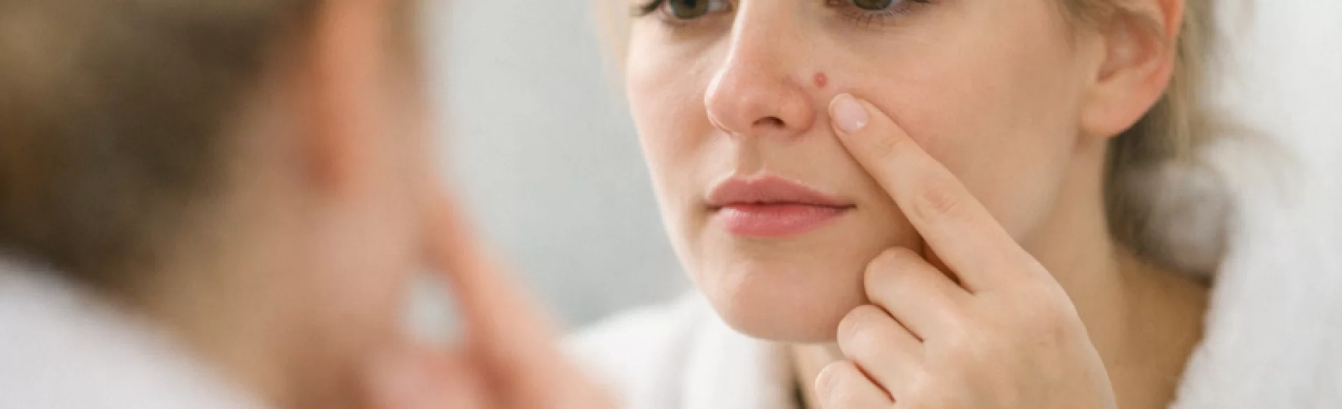 Pimples near the nose