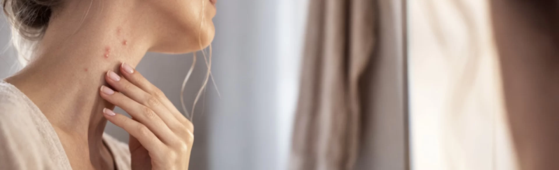 Purulent pimples on the neck