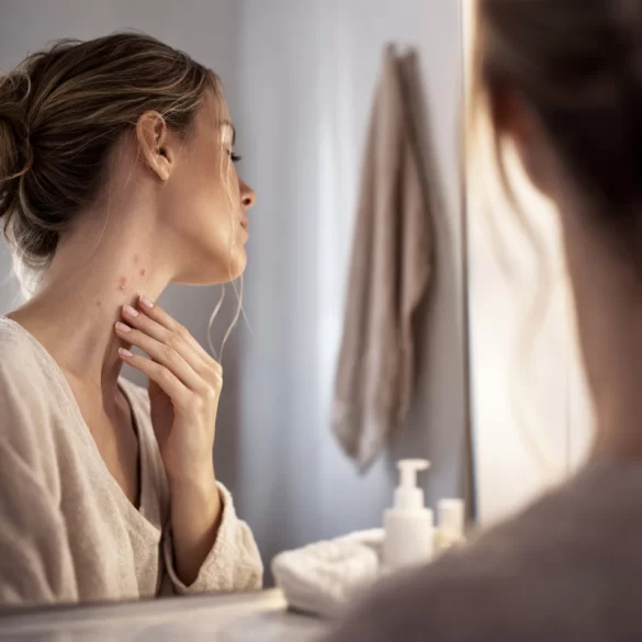 Purulent pimples on the neck