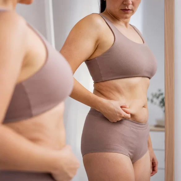 Body skin after weight loss