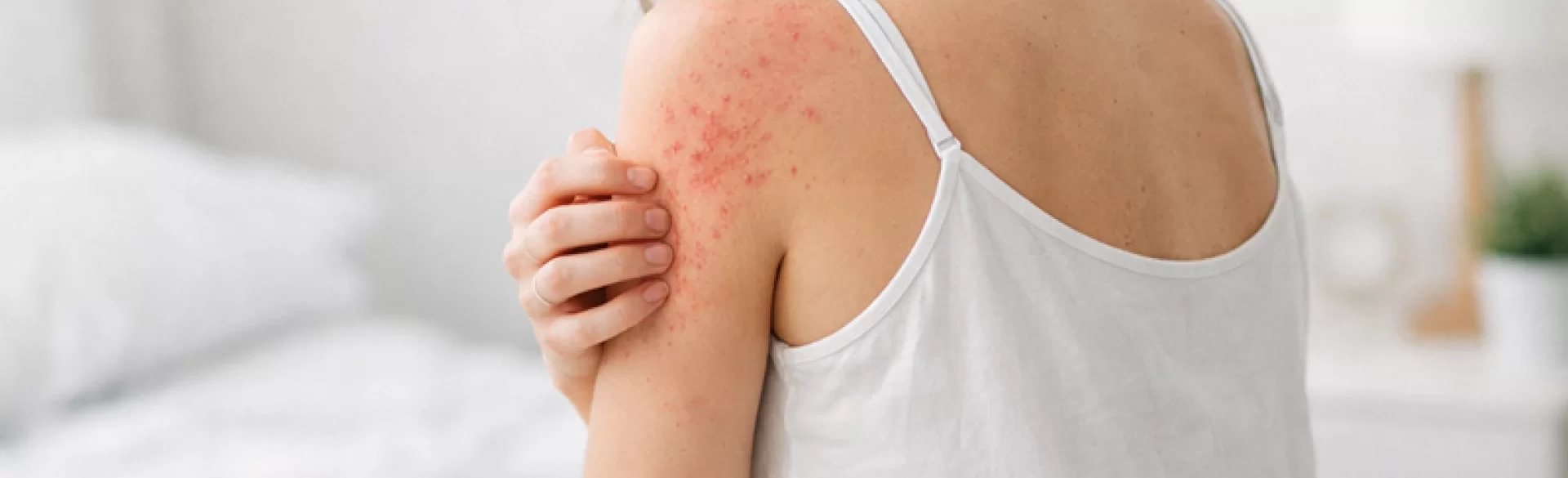 Itchy bumps on the body