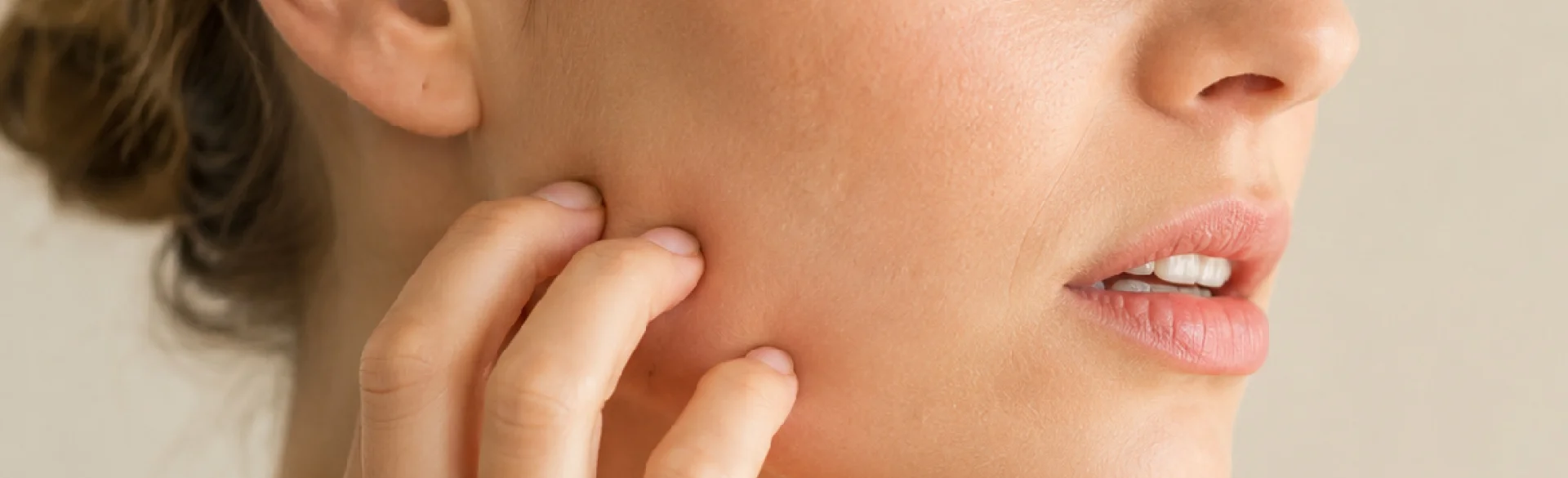 Itchy skin
