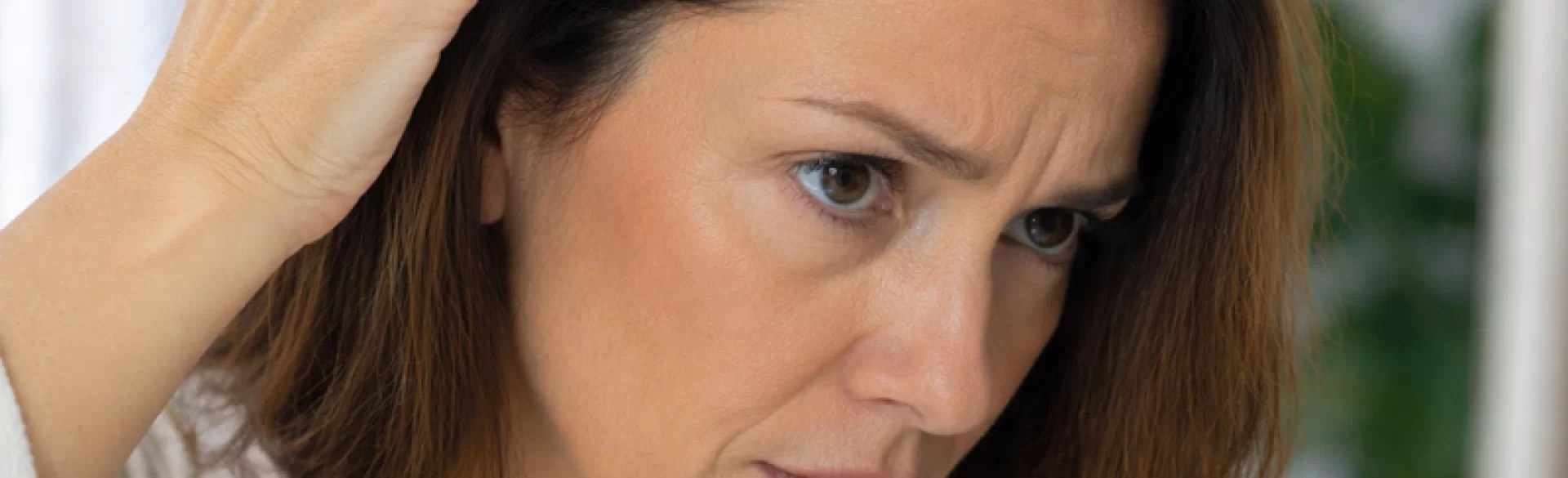 Receding hairline on the head