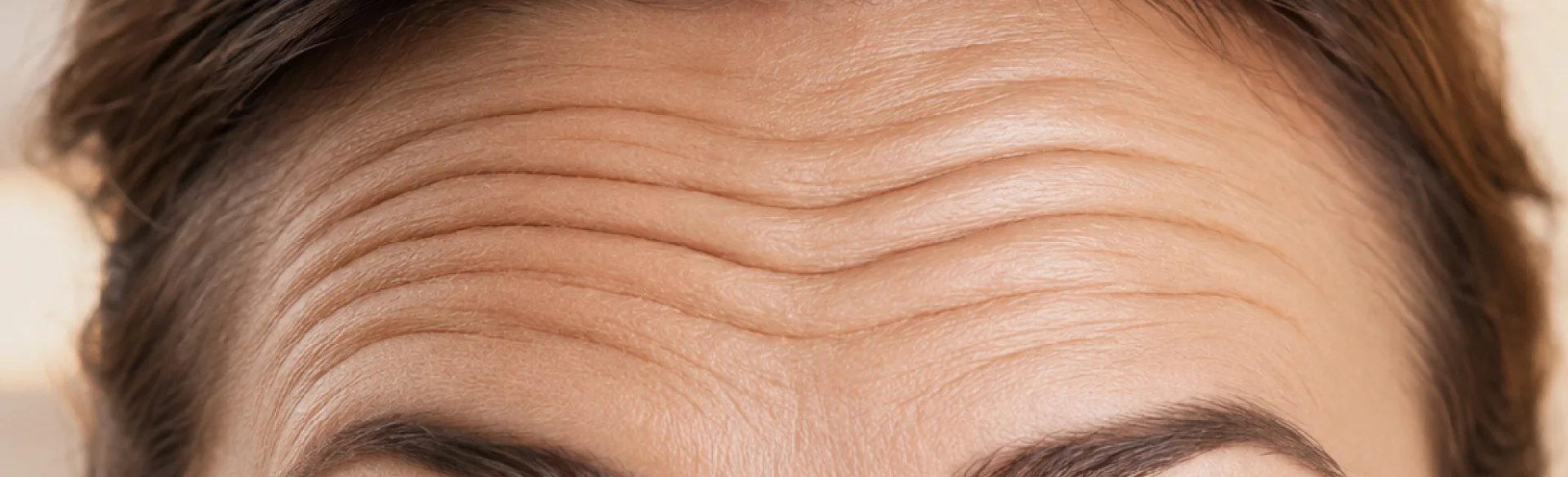Forehead wrinkles