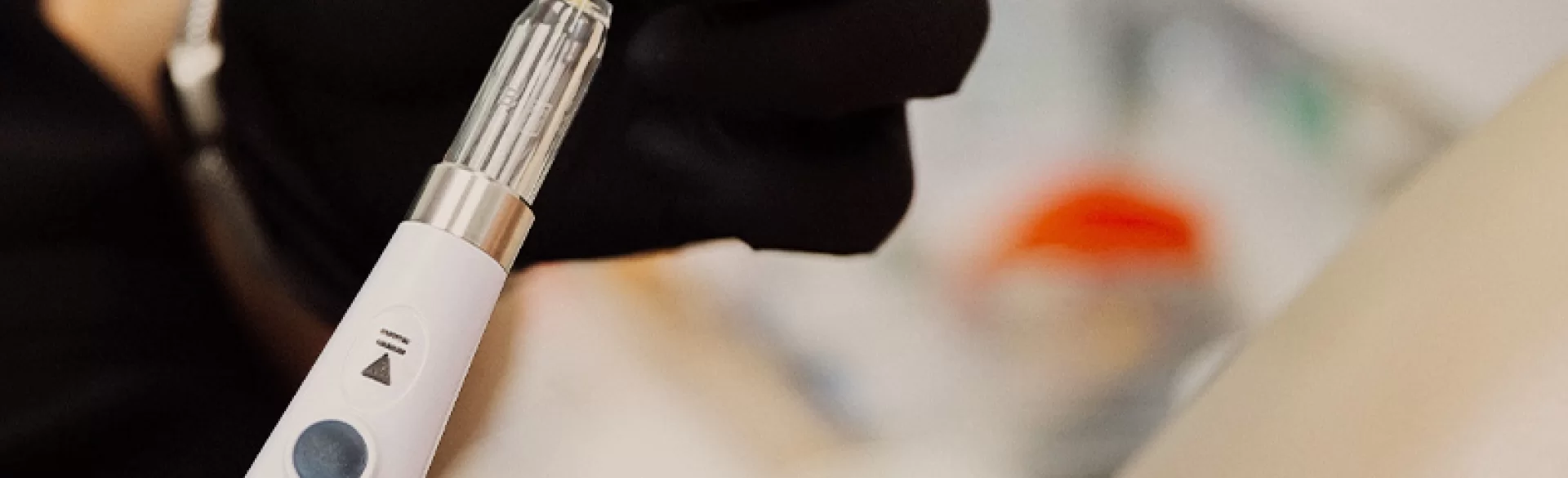 Infiltration anesthesia