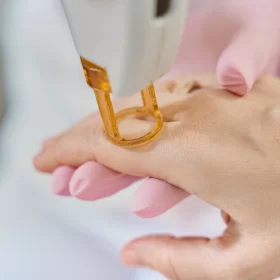Fractional ablative pixel CO2 laser