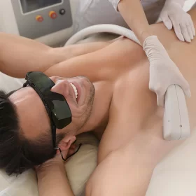HAIR REMOVAL FOR MEN