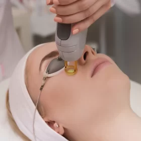 LASER REMOVAL OF DISCOLORATION