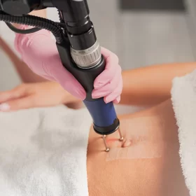 STRETCH MARKS REMOVAL 