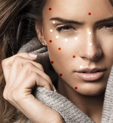 Collagen mesotherapy - regeneration of skin bio-revitalization.