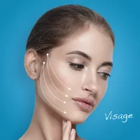 Thread lifting